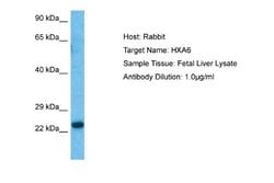 HOXA6 Antibody, Novus Biologicals 100 &mu;L | Buy Online | Novus Biologicals | Fisher Scientific